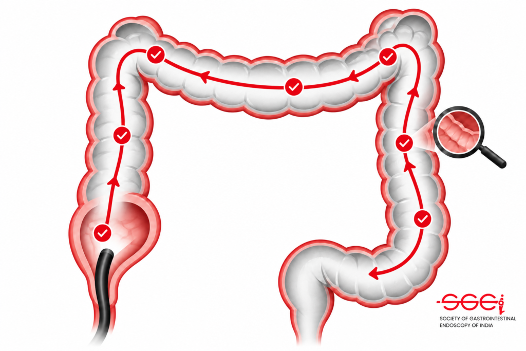 colonoscopy quality indicators